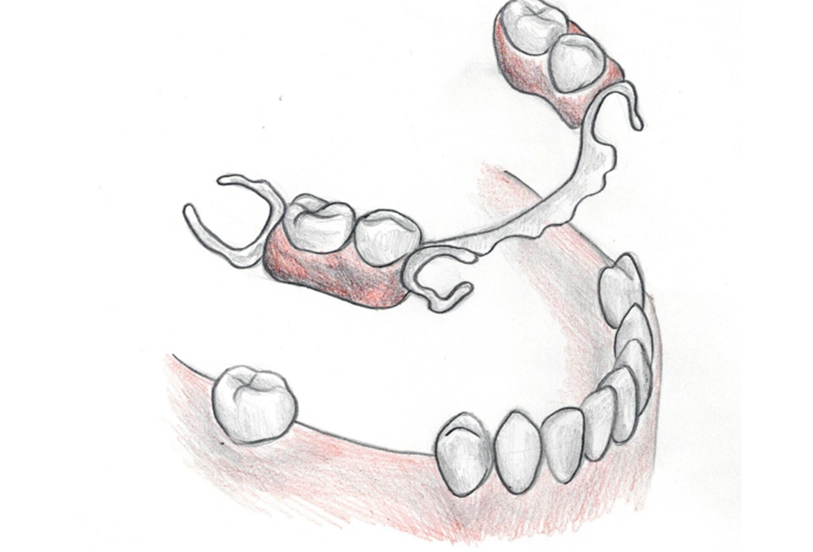 protetyka_5a